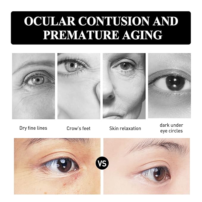 Snake Peptide Eye Cream，Anti-Aging Eye Cream for Dark Circles, Puffiness & Wrinkles, Hydrating Eye Treatment with Niacinamide & Glycerin (2)