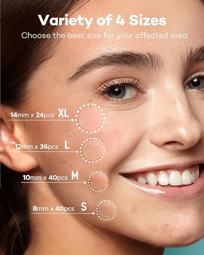 TKTK Pimple Patch Acne Patch, 4 Sizes 140 Patches Acne Absorbing Cover Patch, Hydrocolloid Invisible Acne Patches for Face Zit Patch Acne Dots Tea Tree, Calendula Oil