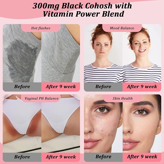 Menopause Supplement for Women: Hormone-Free Probiotic with Black Cohosh & Ashwagandha Support for Hot Flashes Mood Balance & Skin Health 60 Capsules