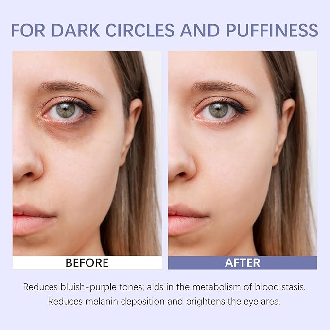 Retinol & Caffeine Eye Balm Stick for Dark Circles, Puffiness, Fine Lines and Eye Bags, Anti Aging Under Eye Cream Smooths Wrinkles Moisture Stick (0.24oz/7g)