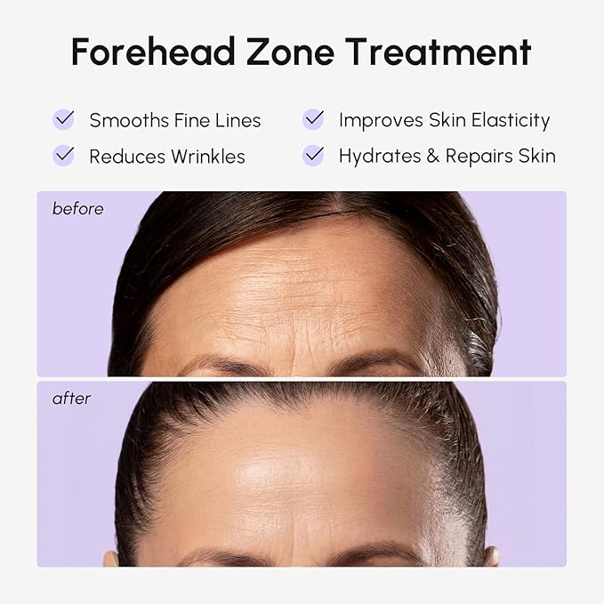 MAREE Forehead Wrinkle Patches – Collagen Wrinkle Patches with Retinol & Hyaluronic Acid for Face Lift – Fine Lines Deep Forehead Wrinkles Treatment Remover – Face Tape for Wrinkles Between Eyebrows