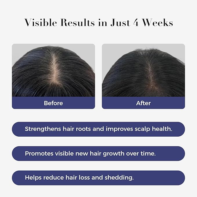 Hair Growth Serum Roll On,3% Rosemary, 6% Batana oil,3% Redensyl & 2% Anagain| No-Rinse, Fast-Absorbing | For Thinning Hair & All Hair Men & Women (1 Pcs)
