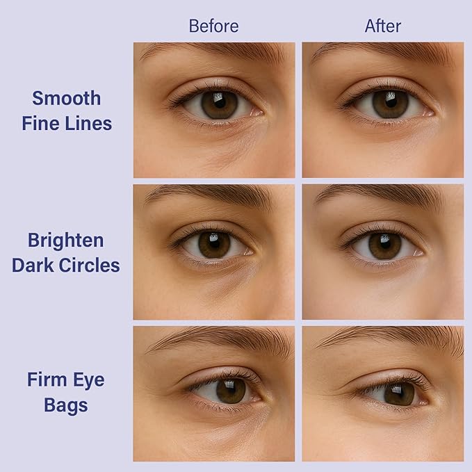 DIAMOND GAZE Firming Hydrogel Eye Patches 28 Pairs, 15-Min Retinol & Niacinamide Eye Masks to Smooth and Brighten, Reduce Fine Lines & Dark Circles, Relaxing Holiday Set