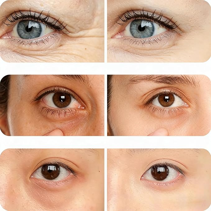 Eye Pods for Under Eyes Bags, Eyes Lift Instant Cream, Red Light Therapy Eyes Pads Patches for Dark (1 PC Eye Pods with 1* Eye Cream)