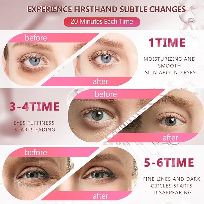 2 Packs 60 Pcs Under Eye Patches, Green+Pink, 30 Pairs Undereye Mask for Puffy Eyes Dark Circles Treatment, Collagen Gel Pads Hydrating for Eye Bags Puffiness Wrinkle, Women Men Beauty Skin Care