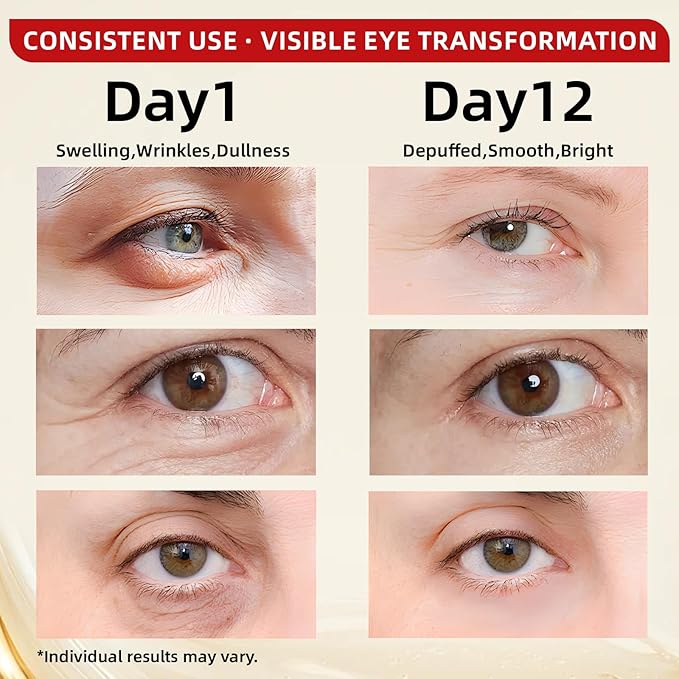 Caffeine & Retinol Under Eye Serum – Dermatologist-Tested, Fast Absorbing, Correction for Puffy Eye Bags Fine Lines Dark Circles Wrinkles While Providing Moisturizing Care