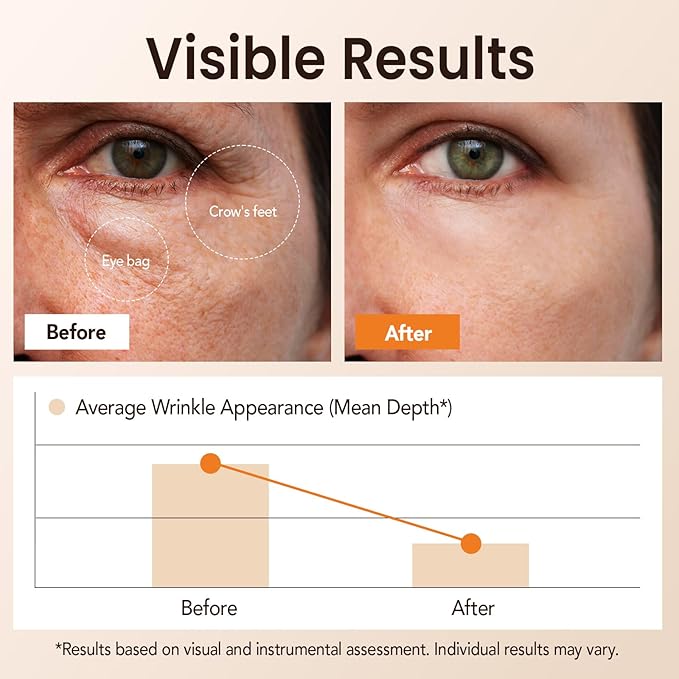 Instant Eye Tightener Cream for Under Eye Bags, Temporary Under Eye Firming for Puffiness & Fine Lines, Fast-Acting, All Skin Types, Makeup Friendly Eye Rescue for All Occasions