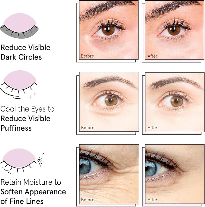 grace & stella Under Eye Patches (12 pairs) Eye Masks for Puffy Eyes and Dark Circles - Gifts for Her, Bridesmaids, Birthdays, Bachelorette Party, Self Care Gifts for Women - Vegan Cruelty-Free