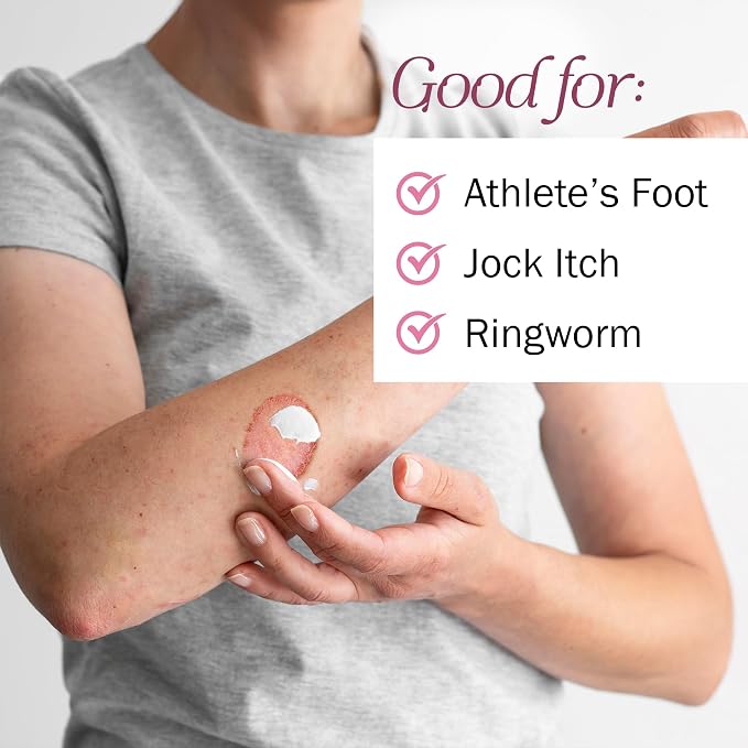Clotrimazole Antifungal Cream for Skin - 1 Pack with 4 oz. of Clotrimazole Cream for Jock Itch, Athletes Foot Treatment, and More