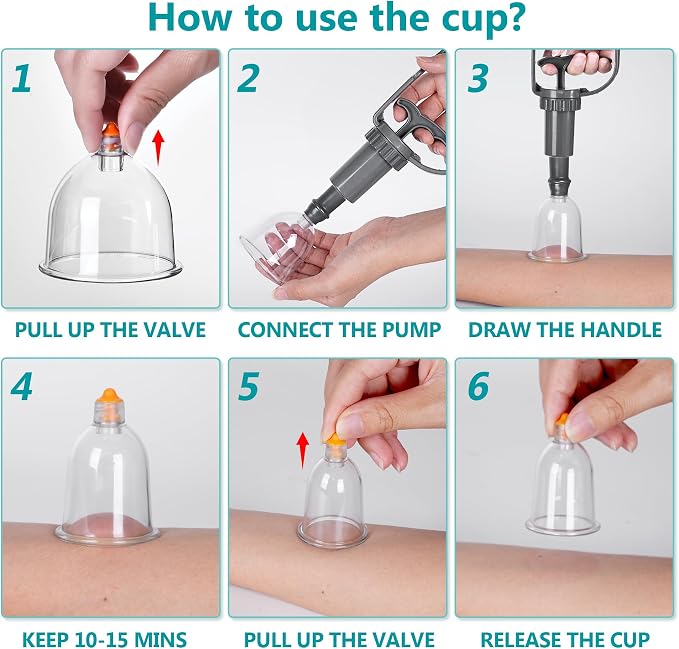 Cupping Therapy Set, 24 Pcs Cupping Set, Professional Cupping Kit for Massage Therapy, Portable Upgrade Cupping with Case, Pump Suction Cups for Cellulite Muscle Pain Relief Physical Therapy