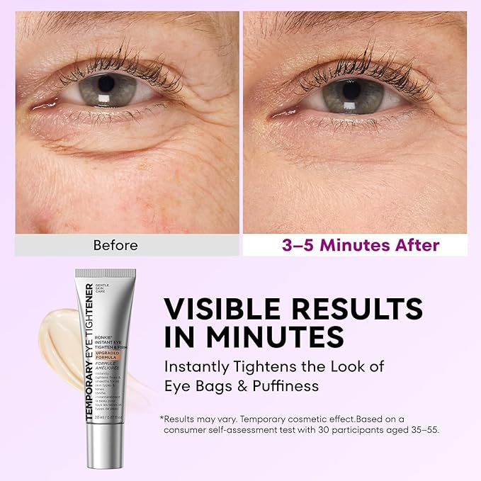 RONKIE Instant Firm Eye Tightener: Upgraded Formula for Women Helps Reduce Eye Bags Puffiness and Wrinkles in 3-5 Minutes When Time Matters 0.67 oz