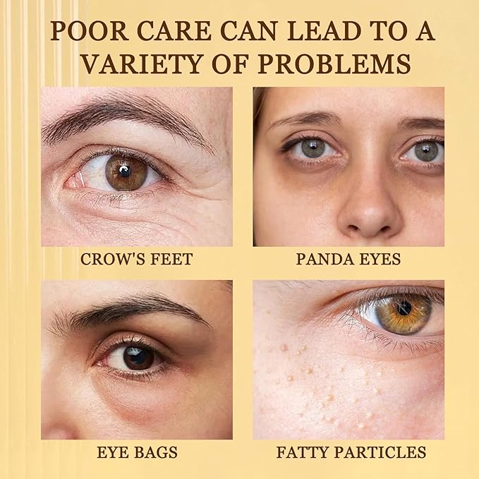 30 Pairs Under Eye Patches,Hydrating Under Eye Masks,Moisturizing Undereye Mask Patches for Eye Care,Travel Eyemask Skincare Eye Pads for Dark Circles,Birthday Gifts for Women