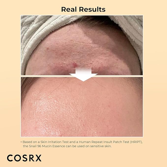 COSRX 2% Alpha Arbutin Discoloration Care Serum + Snail Mucin 96% Power Essence