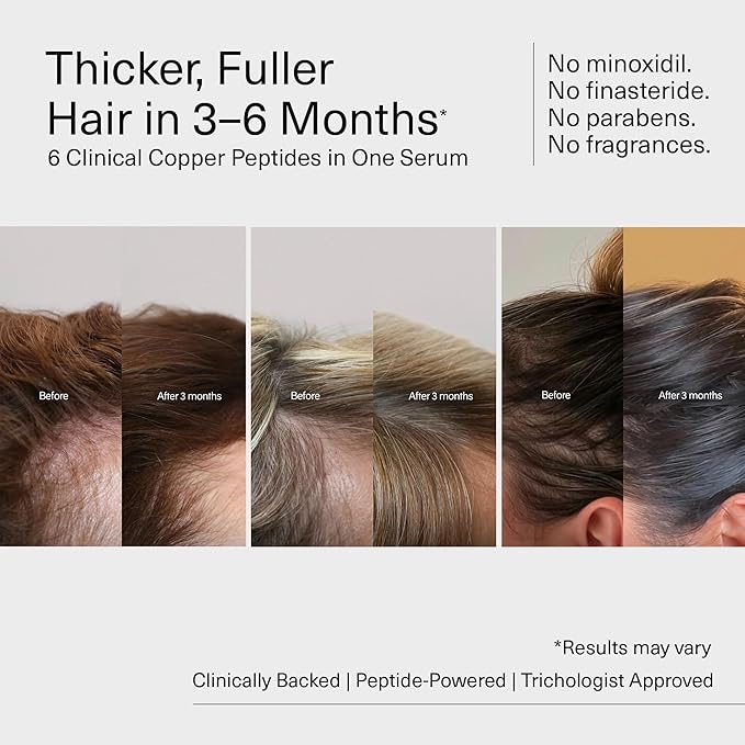 Bloom Clinically Proven Copper GHK-CU Peptide Hair Serum for Hair Growth - Non-Greasy & Lightweight Advanced Multi Copper Peptides for Thinning Hair - Made in USA - 3-Pack for 3 Months Supply