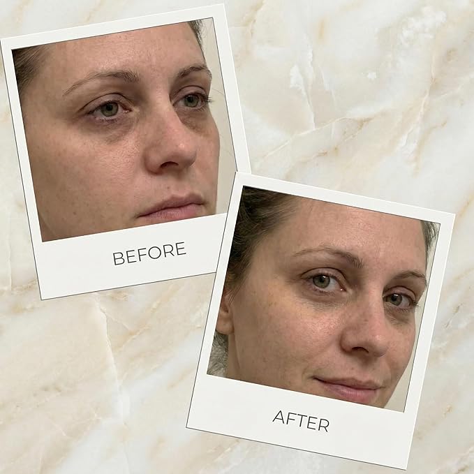 YUNASENCE ILIGHT Organic Advanced Illuminating & Line Smoothing Eye Treatment, 0.5oz. For Dark Circles, Puffiness, Fine Lines.