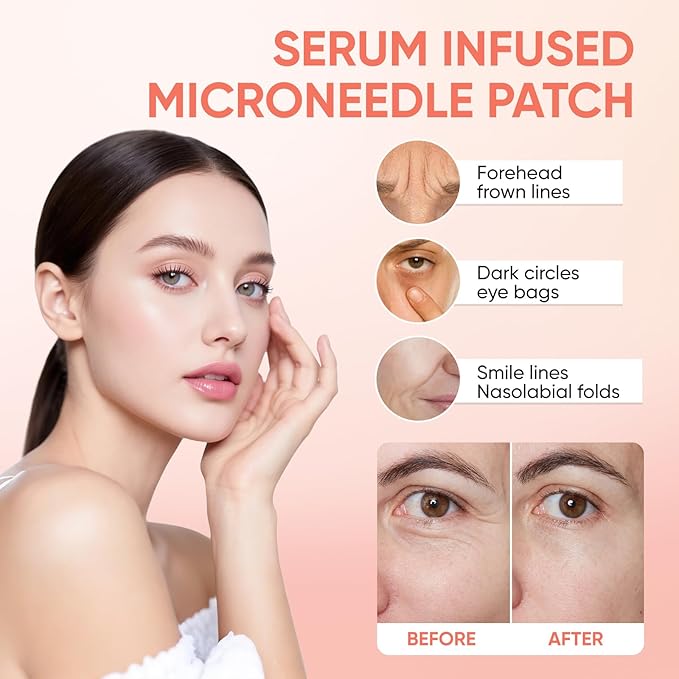 MicroGlow Eye Patches,Under Eye Patchs Hyaluronic Acid Eye Mask for Dark Circles for Women, Forehead Wrinkle & Smile Line Patches (2BOX(6 Pairs))