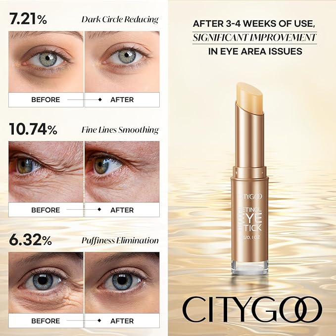 CITYGOO Retinol Eye Stick With Collagen, Hyaluronic Acid For Dark Circle, Under Eye Cream Anti Aging, For Puffiness and Bags Reduces Fine Lines (Retinol Premium Gold Edition 3g)
