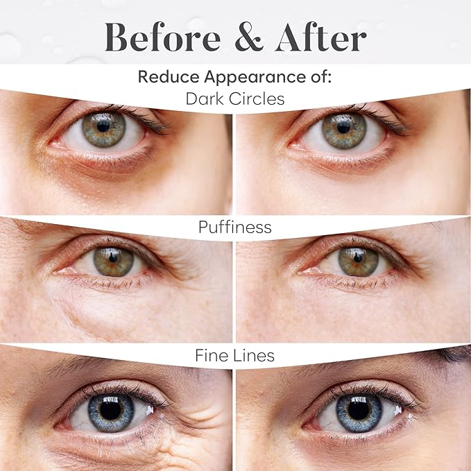 BLOOMORA Variety Box Under Eye Patches for Puffy Eyes and Dark Circles(30 PAIRS), Collagen & Hyaluronic Acid Gel Masks for Hydration, Anti Wrinkle Patches, Bridesmaid Gifts, Bachelorette Party Favors