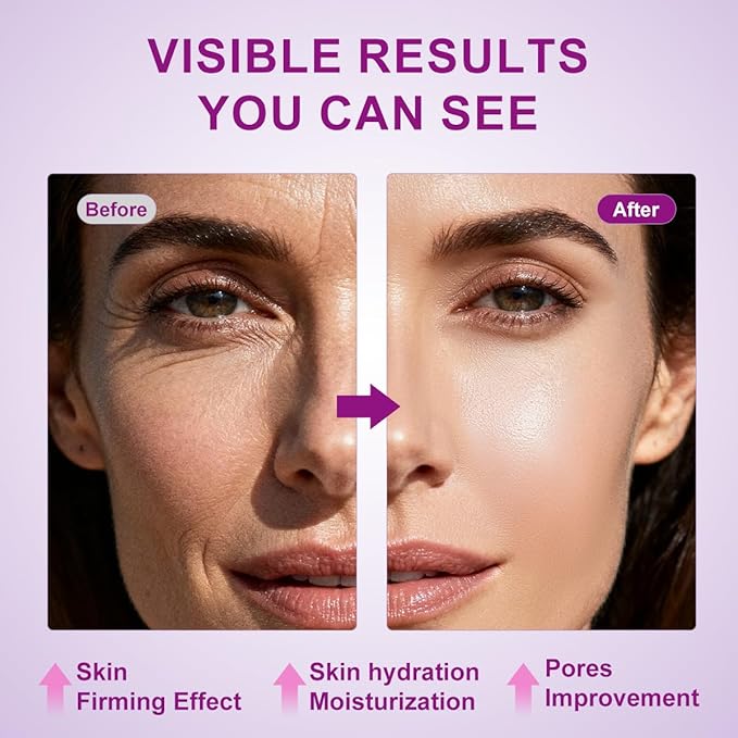 Bakuchiol Plumping Face Serum, Natural Retinol Alternative Serum For Face, Vitamin Illuminating Serum For Sensitive Skin With 2.5% Niacinamide & Hyaluronic Acid, Pore & Wrinkle Korean Skin Care