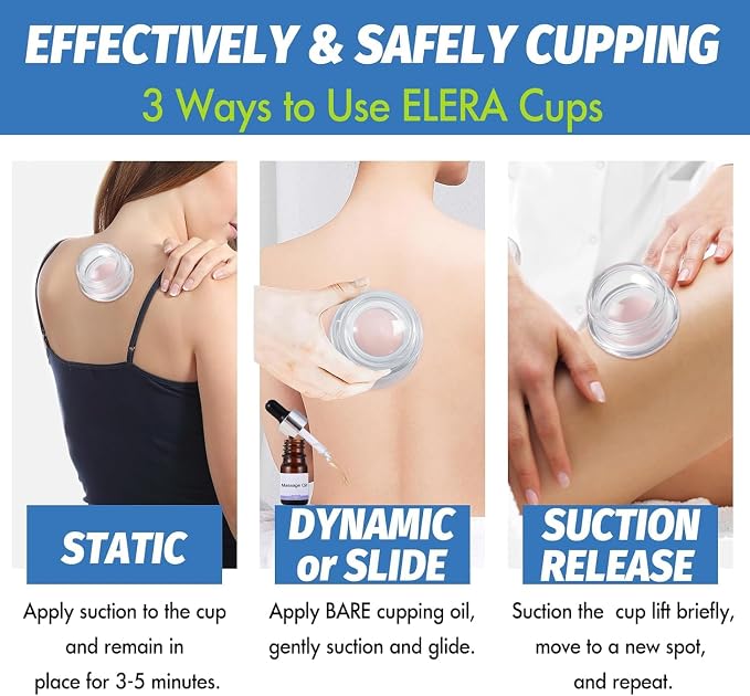 ELERA Silicone Cupping Therapy L Size Sets, Professionally Chinese Massage Cups Tools, Silicone Cup for Joint Pain Relief, Massage Body (L*2 Cups)