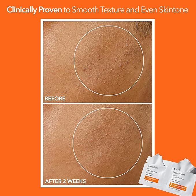 Dr. Dennis Gross Alpha Beta Universal Daily Peel: for Uneven Tone or Texture and Fine Lines or Enlarged Pores, (60 Treatments)