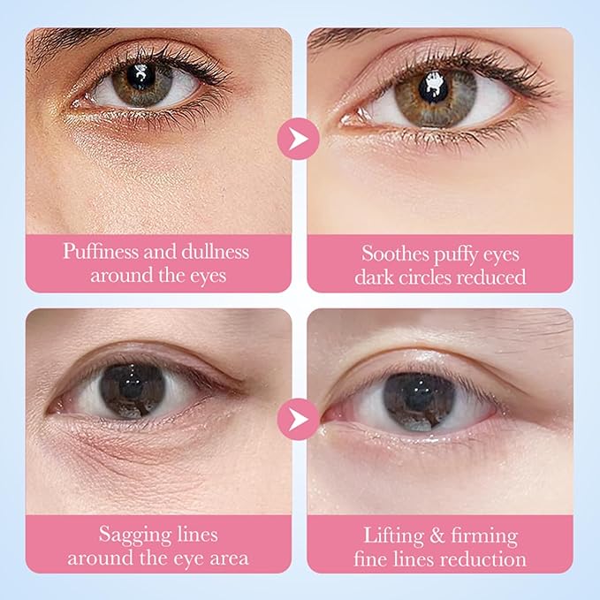 Sakura Eye Masks, 30 Pairs Collagen Gel Under Eye Patches, Crystal Eye Masks Reduce Wrinkles and Dark Circles, Moisturizing & Anti-Aging Reducing Eye Wrinkles Skincare