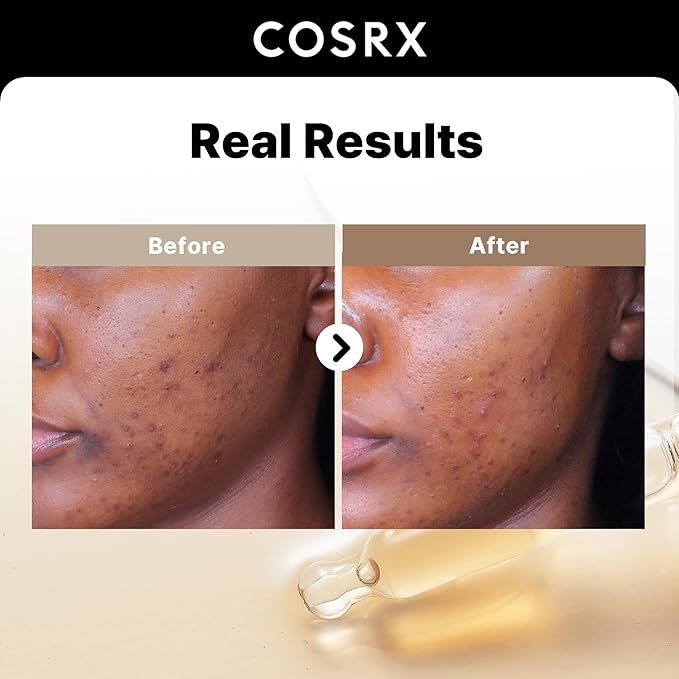 COSRX Glass Skin Starter Set + 2% Alpha Arbutin Discoloration Care Serum