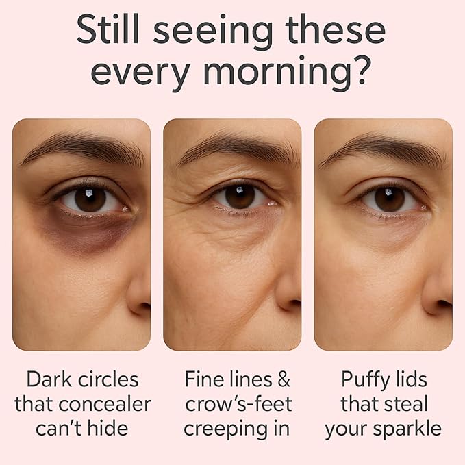 Mtmult Eye Cream Anti Aging Salmon DNA PDRN Pink Peptide Skin Care with 5% Niacinamide, Retinol, Peptides, Sodium Hyaluronate | Eye Treatment for Fine Lines, Dark Circles | 1.01fl.oz