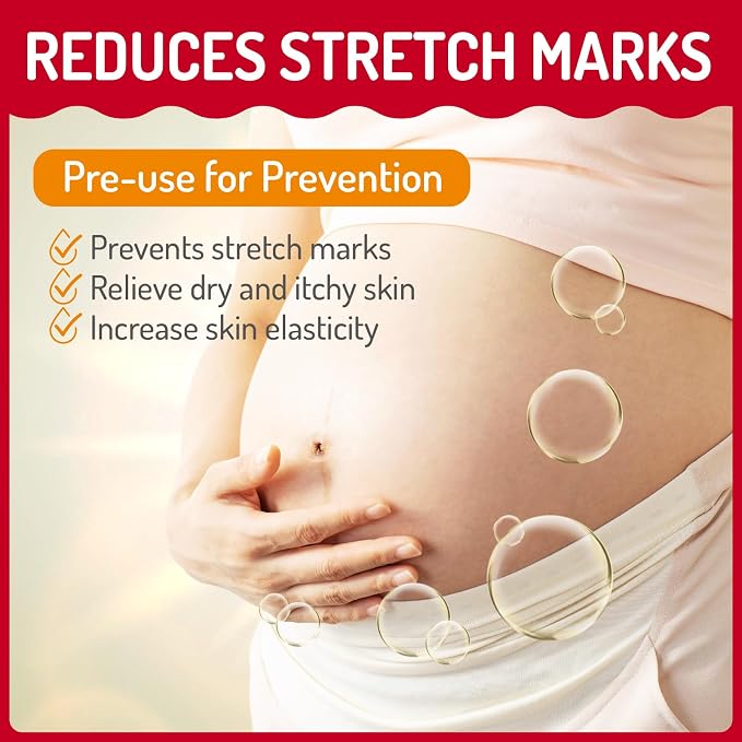 Stretch Mark Oil for Pregnancy Massages Body & Reduces Scar Appearance, Removes Stretch Mark Prevention, Prenatal & Postnatal Tummy Skin Care, Firming Skin Elasticity for Maternity, 2.03oz(1Pack)