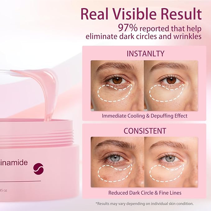 Under Eye Patches Brightening Cooling Hydrating Eye Masks for Dark Circles, Puffiness & Wrinkles, Infused with Caffeine and Hyaluronic Acid, Soothing Anti-Aging Treatment for Women & Men