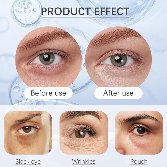 Perfection Eye Tightener - Instant Firming Primer with Hyaluronic Acid & Vitamin E, Easy-Wear Formula for Ultimate Lift & Smooth Finish, Hydrates & Refreshes Tired Eyes (1)