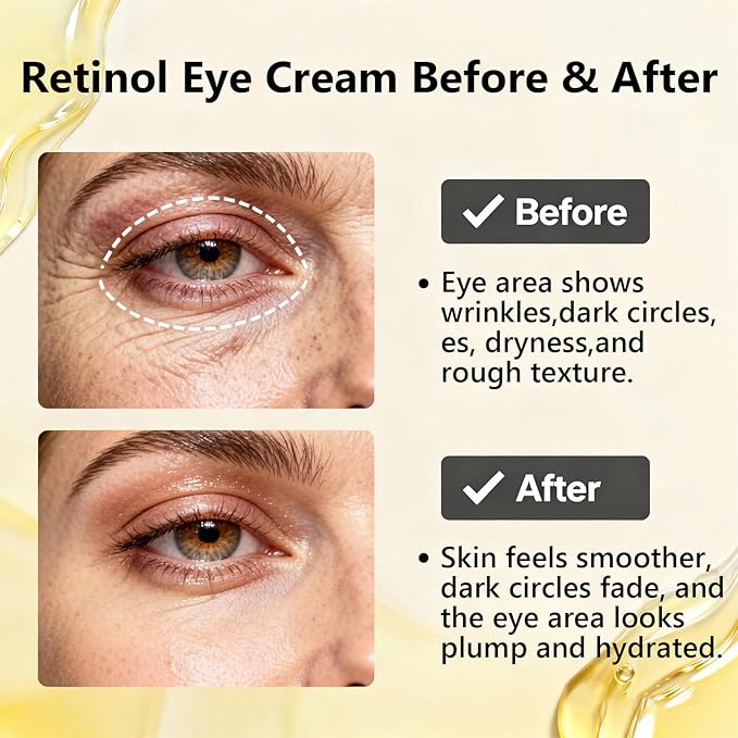Retinol Under Eye Cream,Vitamin E & Niacinamide – Reduces Appearance of Wrinkles & Dark Circles&Puffiness, Anti-Aging Eye Cream for Fine Lines,Daily & Night Use,Men & Women (1 fl.oz)