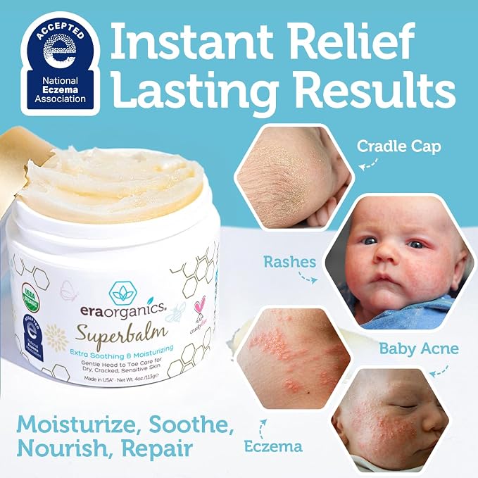 Era Organics Healing Ointment for Babies - USDA Certified Organic Natural Moisturizer Gentle on Sensitive Skin Prone To Baby Eczema, Cradle Cap (Infant Seborrheic Dermatitis), Rashes, Hives - 4oz
