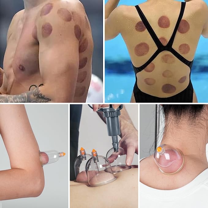Cupping Therapy Set, 24 Pcs Cupping Set, Professional Cupping Kit for Massage Therapy, Portable Upgrade Cupping with Case, Pump Suction Cups for Cellulite Muscle Pain Relief Physical Therapy