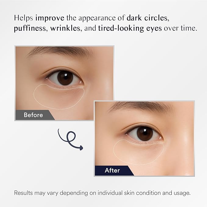 Under Eye Patches for Puffiness and Bags: Eye Mask for Puffy Eyes and Dark Circles Treatment (Navy)