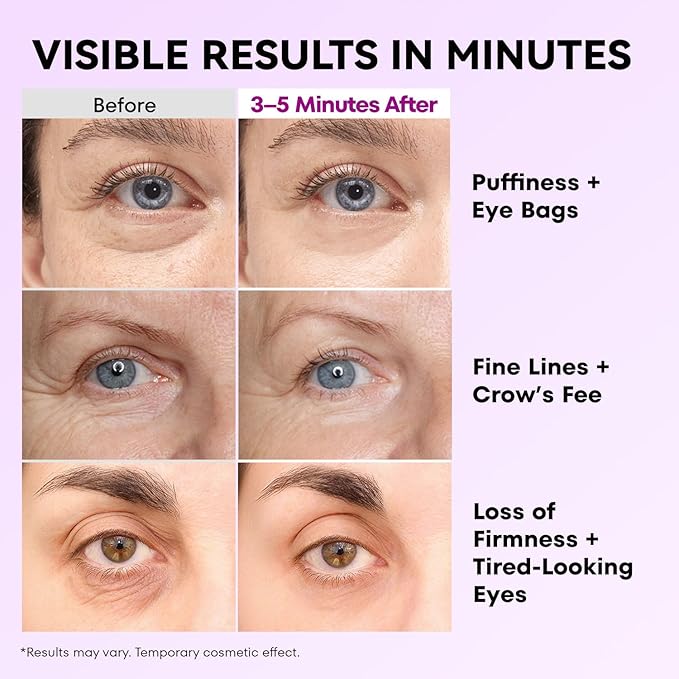 RONKIE Instant Firm Eye Tightener: Upgraded Formula for Women Helps Reduce Eye Bags Puffiness and Wrinkles in 3-5 Minutes When Time Matters 1.34 oz