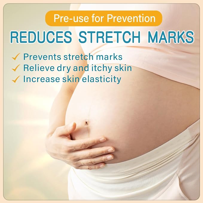 Stretch Mark Cream for Pregnancy & Postpartum,with Argan Oil, Shea Butter & Vitamin E,Stretch Mark Prevention for Belly,Moisturize Skin,Prevent & Fade stretch marks (300ml_1PACK)