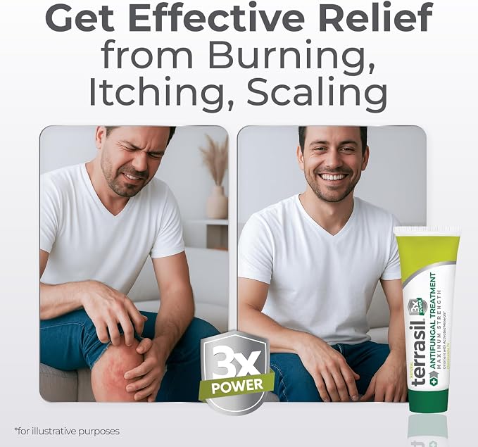 terrasil Clotrimazole Antifungal Cream, Relief for Fungal Yeast Infection, Athletes Foot Treatment, Jock Itch Ringworm, Men & Women, Natural Ingredients, Anti Fungal Cream for Skin and Feet (1.7oz)