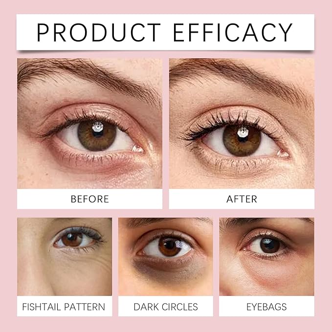 Eye Patches, 1 Bag(3Patches) Hyaluronic Acid & Collagen Under Eye Mask for Dark Circles, Puffiness & Fine Lines, Deep Hydrating Anti-Wrinkle Eye Pads + Forehead