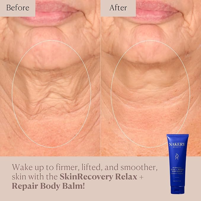 Nakery Beauty SkinRecovery Relax + Repair Body Balm, Magnesium Melatonin Sleep Lotion with Retinol + SepiLift, Firming Cream for Crepey Sagging Skin Overnight, Shea Butter, Lavender Chamomile, 250mL