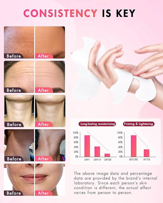 UKVOA Forehead Wrinkle Patches & Smile Line Patches, Overnight Facial Wrinkle Treatment with Hyaluronic Acid, Aloe, Collagen & Vitamin E to Lift Smile Lines for Women 36pcs with Neck Firming Cream