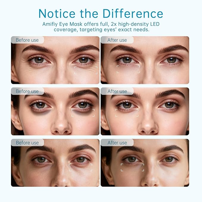 Red Light Therapy for Eyes, 3 Minutes NIR Red Light Eye Mask Reducing Under Eye Dark Circles, Eye Bags, Puffy Eyes, Wrinkles, Infrared LED Eye Mask Anti-Aging Device For Women & Men