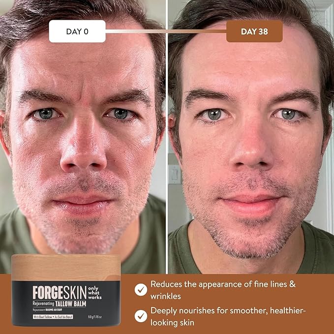 Forge Skin® Wrinkle Defense Beef Tallow Balm for Men [TALLOW-BASED] Moisturizer for Face Hydration - Hydrating AntiAging Skin Cream Natural Facial Skincare Lotion with Essential Oils (1.7oz Each) 6pk