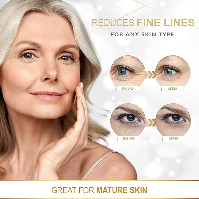 MEDB Re-vitalizing Hyaluronic Aqua Hydrogel Eye Patch | Korean Skincare | Deep Hydration & Wrinkle Care | Calming Eye Patches for Dry, Sensitive Skin | 60 Patches (30 Pairs)