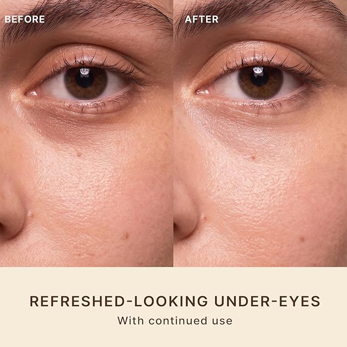 Beauty by Earth Caffeine Eye Cream for Puffiness & Bags Under Eyes - USA Made with Natural & Organic Ingredients, Under Eye Cream for Dark Circles with Glycerin & Vitamin E, Brightens & Refreshes