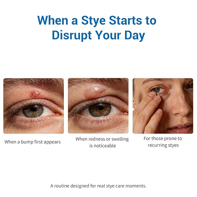 Stye Eye Treatment Kit, Relief for Styes, Chalazions, Blepharitis, Dry Eyes, Irritation and Swelling; Clear Eyes Redness Relief, Stye Eye Compress, Eye Patches, Eye Mask, Eye Stye Treatment