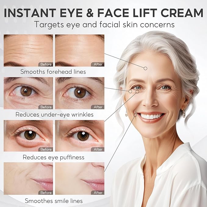 SIX DEGREES Instant Eye & Face Lift Cream, Sodium DNA Gentle Lifting Efficacy, Smoothes Forehead Lines & Fine Lines, Reduces Dark Circles & Puffiness, Deeply Hydrates & Lifts Skin (0.68 fl oz)
