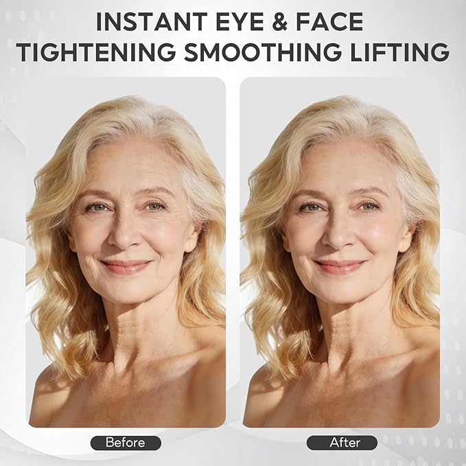 SIX DEGREES Instant Eye & Face Lift Cream, Sodium DNA Gentle Lifting Efficacy, Smoothes Forehead Lines & Fine Lines, Reduces Dark Circles & Puffiness, Deeply Hydrates & Lifts Skin (0.68 fl oz)