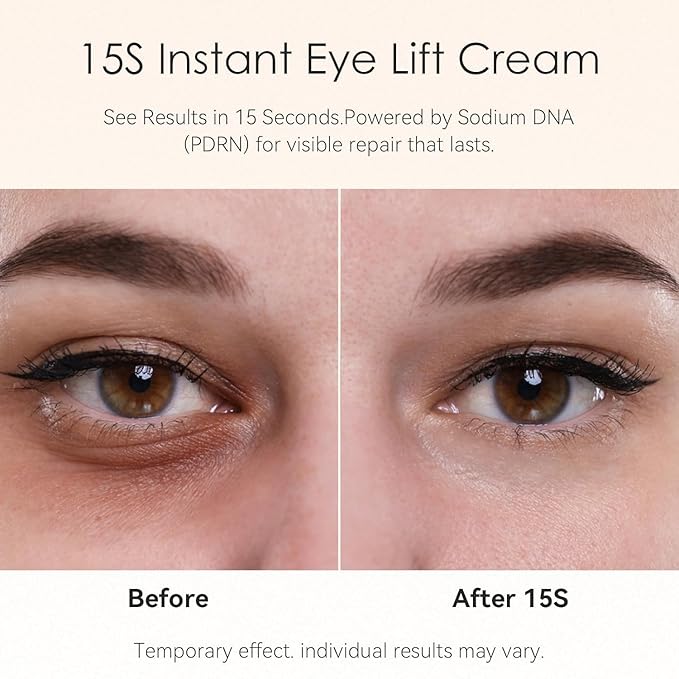 15-Second Instant Eye Lift Cream with Sodium DNA & 0.1% Retinal | Rapid Tightening for Eye Bags & Fine Lines | Dual-Action Firming + Long-Term Repair (0.7 Fl Oz (Pack of 1))