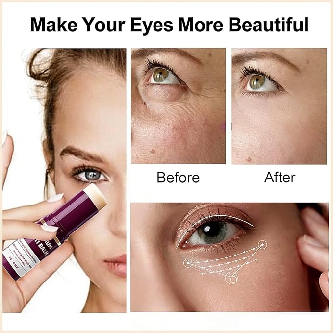 Calcium Multi Balm Stick, Calcium Volume Multi Balm, Under Eye Balm, Korean Collagen Hydrating & Moisturizing Stick, Anti-Aging, Firming Skin, Reduce Fine Lines, Suitable for Face, Eyes, Neck (1)
